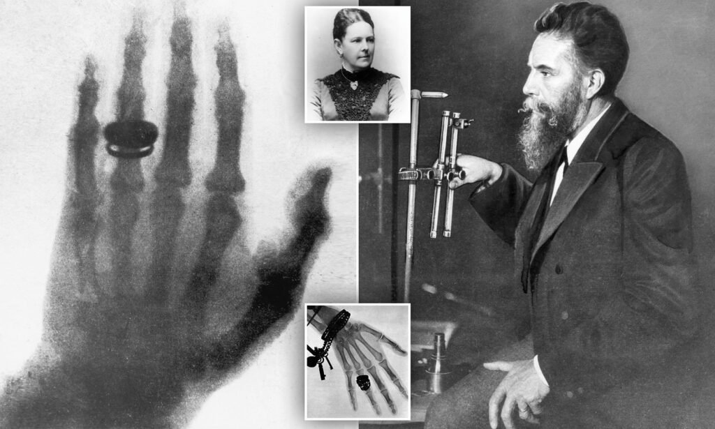 Wilhelm Röntgen ve X Işınları: Tıbbın Dönüşümü
